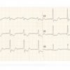Electrocardiograf Mindray R3