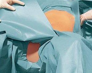 Seturi pentru ginecologie Foliodrape Protect