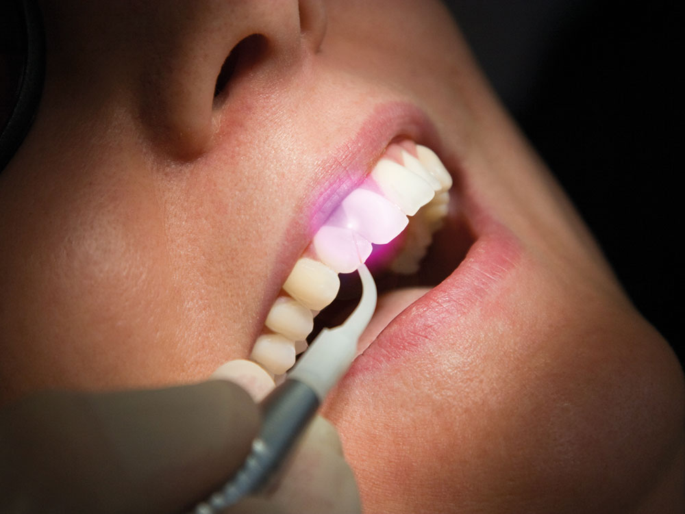 Laser dentar cu moduri duale de utilizare pentru chirurgie și terapie - LUMIX® SURGERY DUAL Dental