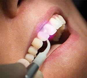 Laser dentar pentru chirurgie LUMIX® SURGERY Dental