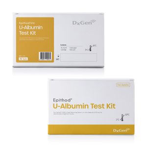 Teste U-albumina Epithod 1 Teste U-albumina Epithod