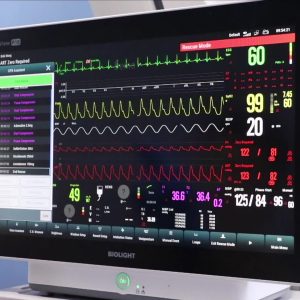 Monitor functii vitale modular Biolight P22