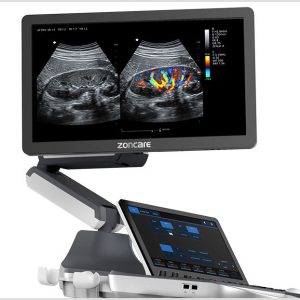 Ecograf Doppler Color Zoncare VIV60